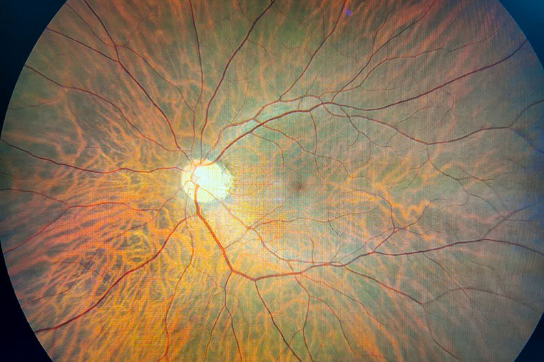 Retina Imaging  Village Optical