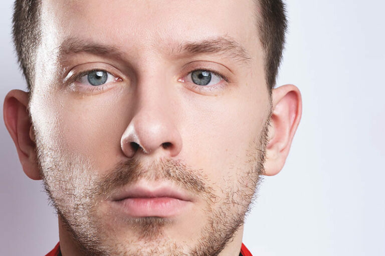 Misaligned Eyes Columbus Strabismus LaGrange West Eye